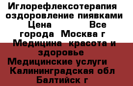 Иглорефлексотерапия, оздоровление пиявками › Цена ­ 3 000 - Все города, Москва г. Медицина, красота и здоровье » Медицинские услуги   . Калининградская обл.,Балтийск г.